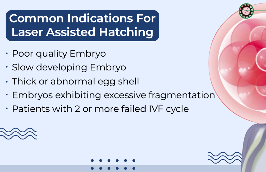 common laser assisted hatching