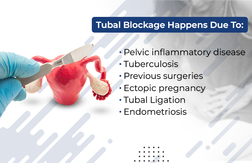 Important point of Tubal Blockage Happens